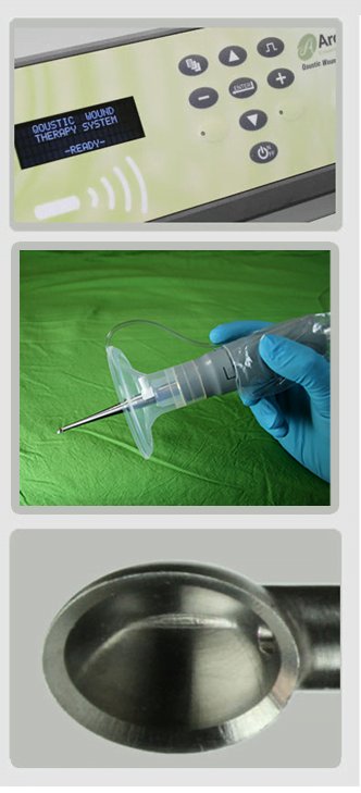 QOUSTIC WOUND THERAPY SYSTEM™